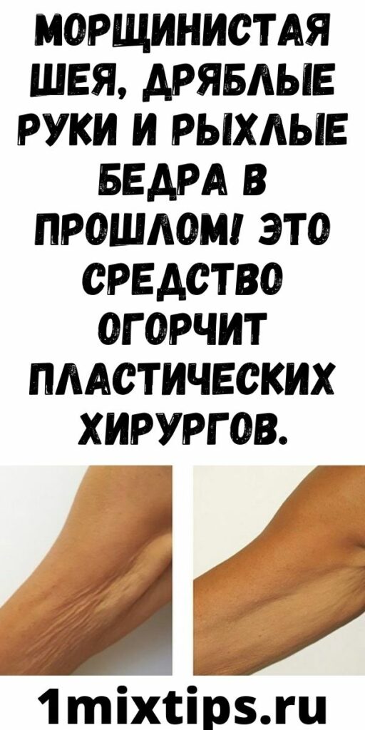 Морщинистая шея, дряблые руки и рыхлые бедра в прошлом! Это средство огорчит пластических хирургов.