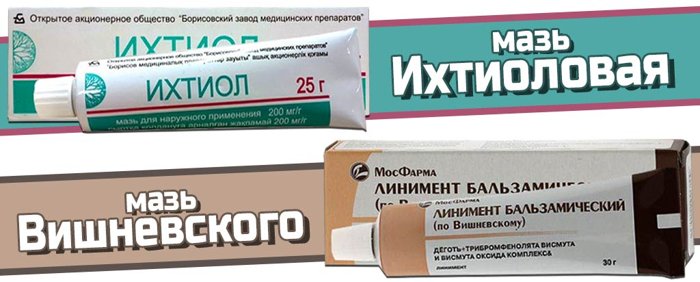 Забытый рецепт волшебной мази от варикозного расширения вен