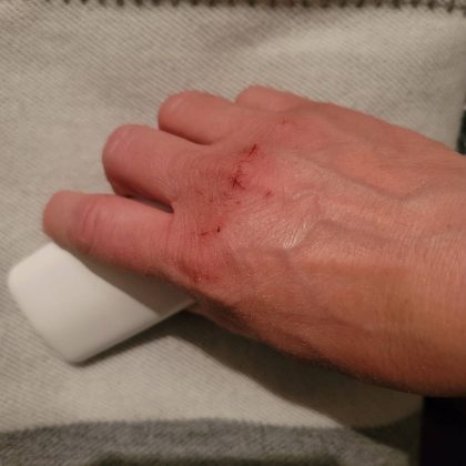 4 зоны на&nbsp;теле, по&nbsp;которым очевидно, женщина запустила себя