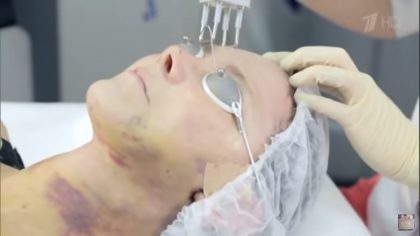 К стилистам &laquo;На&nbsp;10 лет моложе&raquo; пришла 43-летняя, которая выглядит престарелой дамой. Что с ней сделали